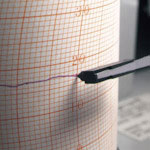 佐藤　カートリッジペン赤　１本　（７２３８－０８）＿